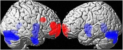 Sex Hormones and Gender Role Relate to Gray Matter Volumes in Sexually Dimorphic Brain Areas